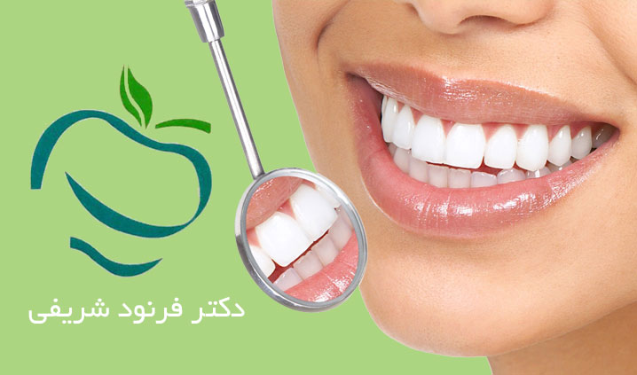 بهترین متخصص ریشه دندان در کرج